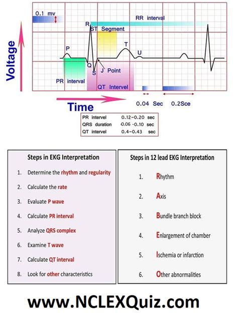 ecg for dummies|10 Steps to Learn ECG Interpretation .